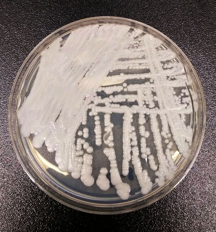 Candida auris is spreading rapidly through the US