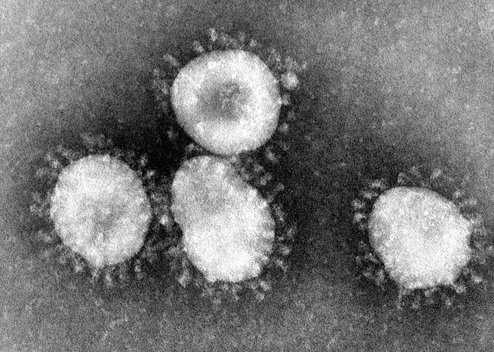 Your coronavirus questions, answered
